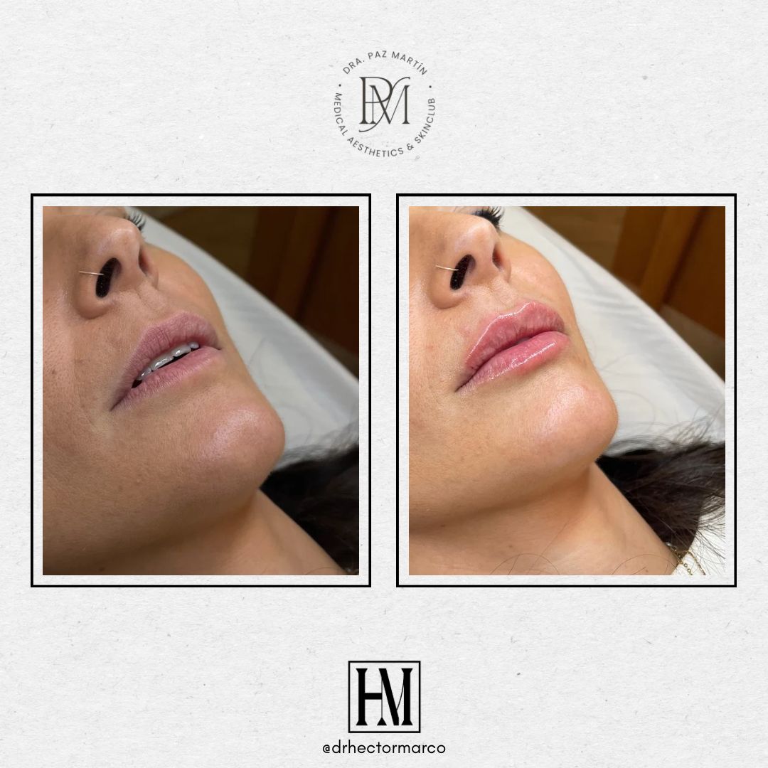 Héctor Marco Ruiz-8