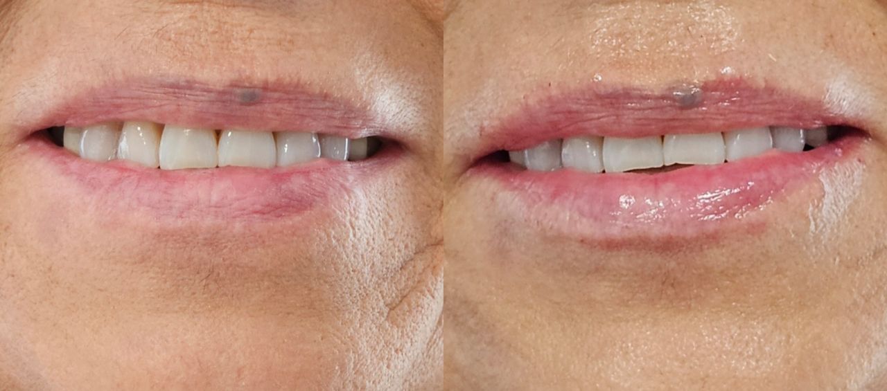 Rosalba Herrero Zerpa-39