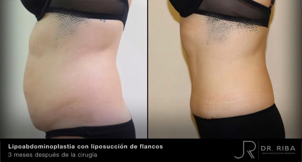 Jordi Riba Vilchez-31