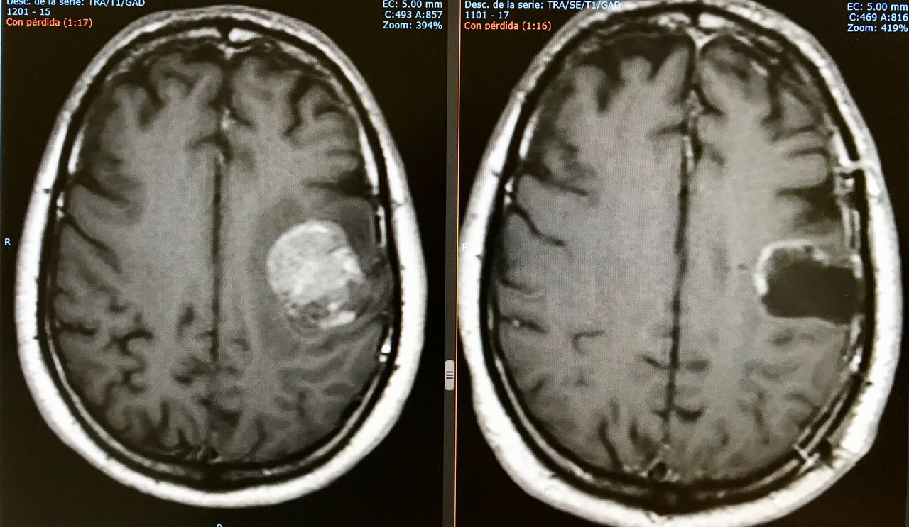 Juan Camilo Hernandez Acevedo-42