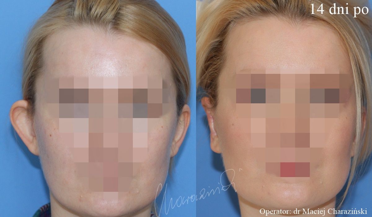 Maciej Charaziński-132