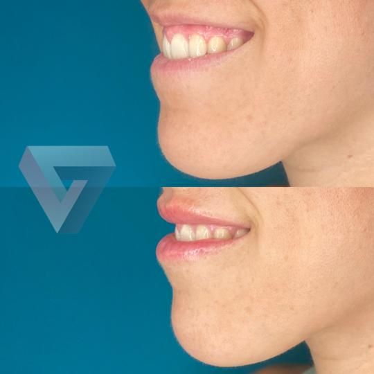 Victoria Trasmonte-43