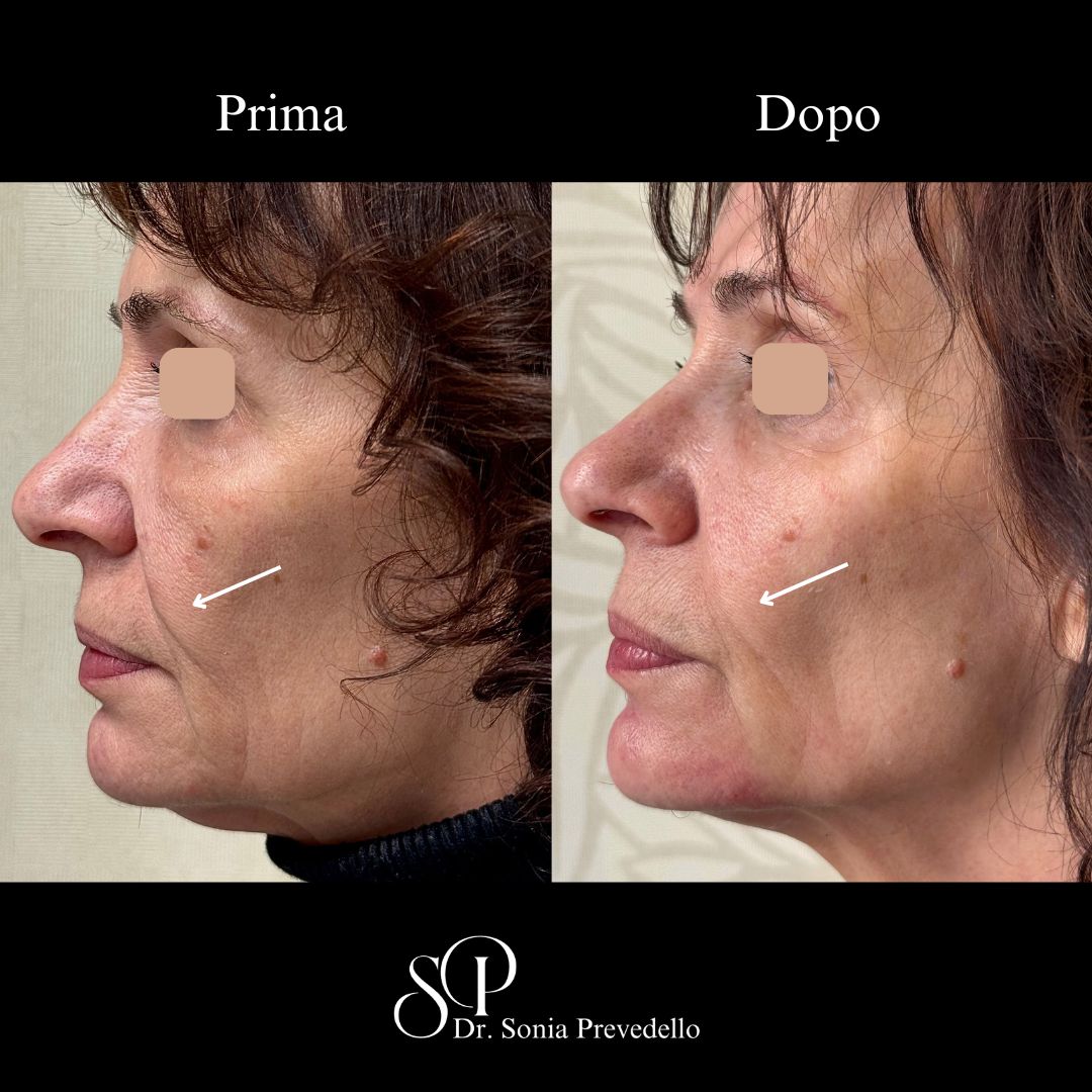 Sonia Prevedello-27
