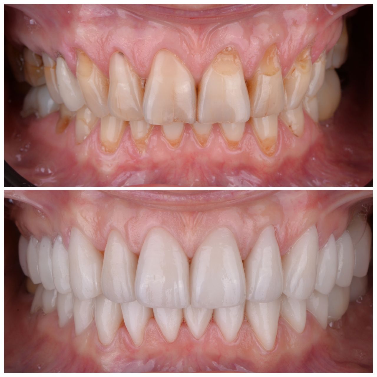 Martin Bartoszcze-17