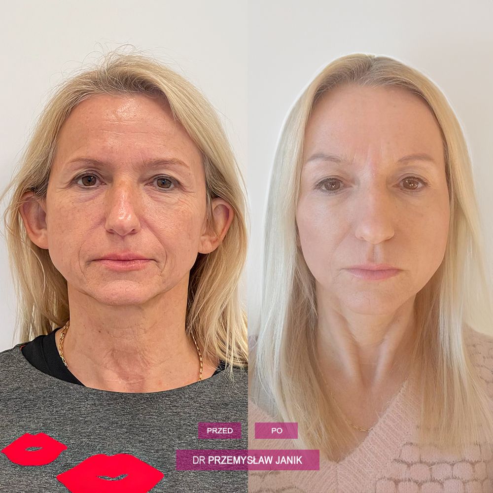 Przemysław Janik-45