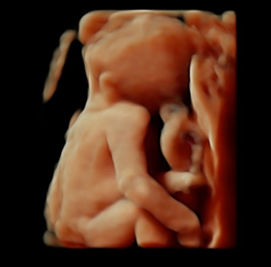 Tommaso Incandela-17