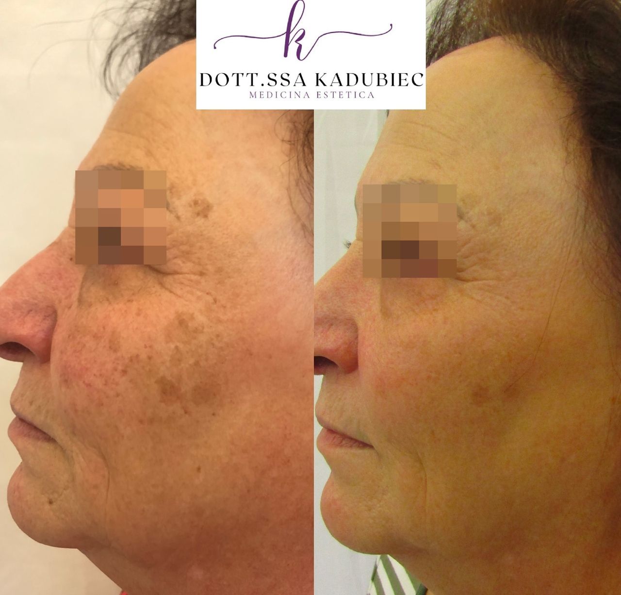 Aleksandra Kadubiec-26