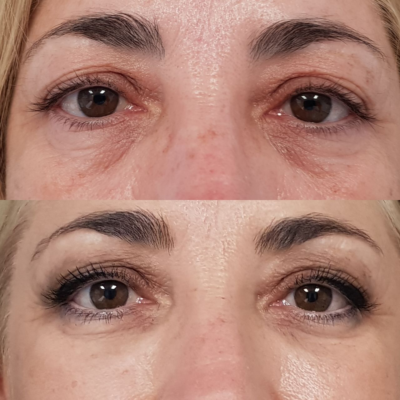 Rosalba Herrero Zerpa-245