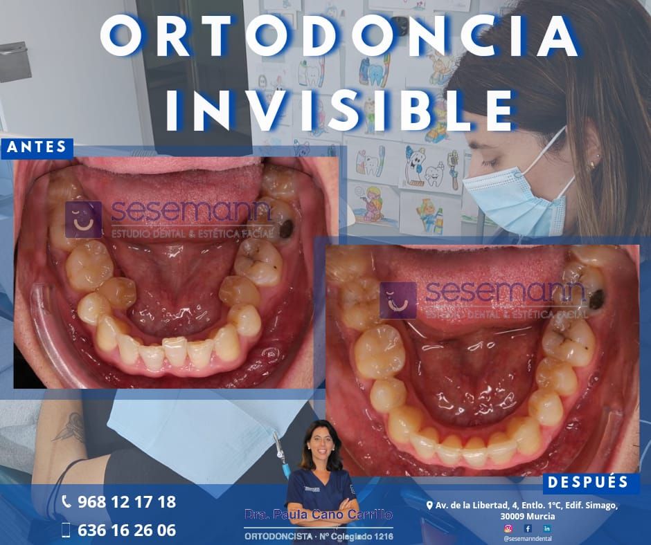 Paula Cano Carrillo-3