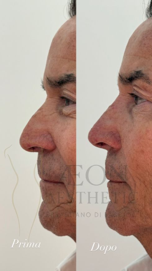 Sebastiano Di Lascio-6