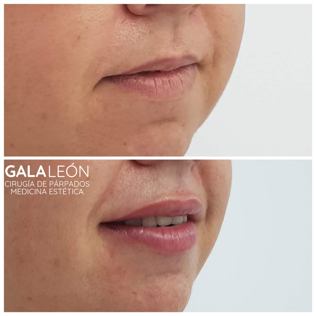 Gala P. Leon Salvatierra-26