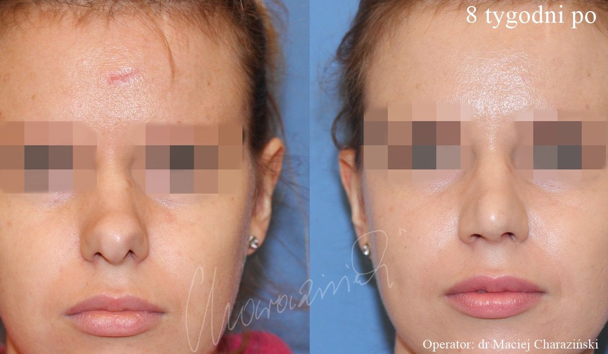 Maciej Charaziński-86