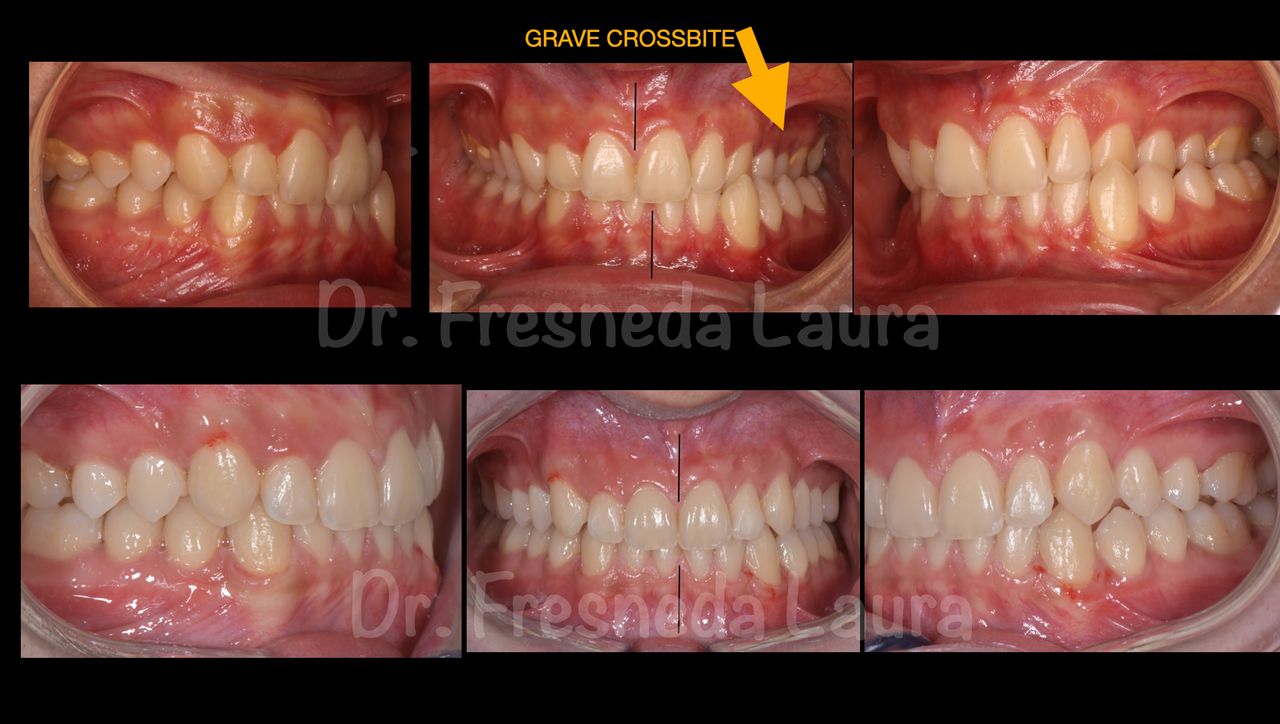 Laura Fresneda Bustos-4