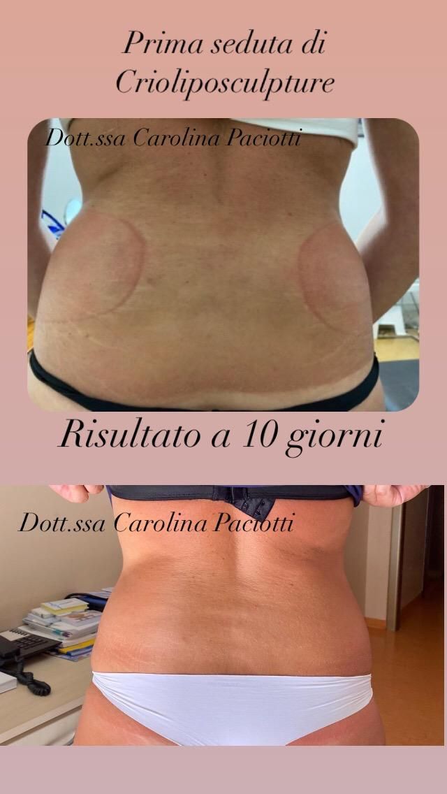 Carolina Paciotti-15