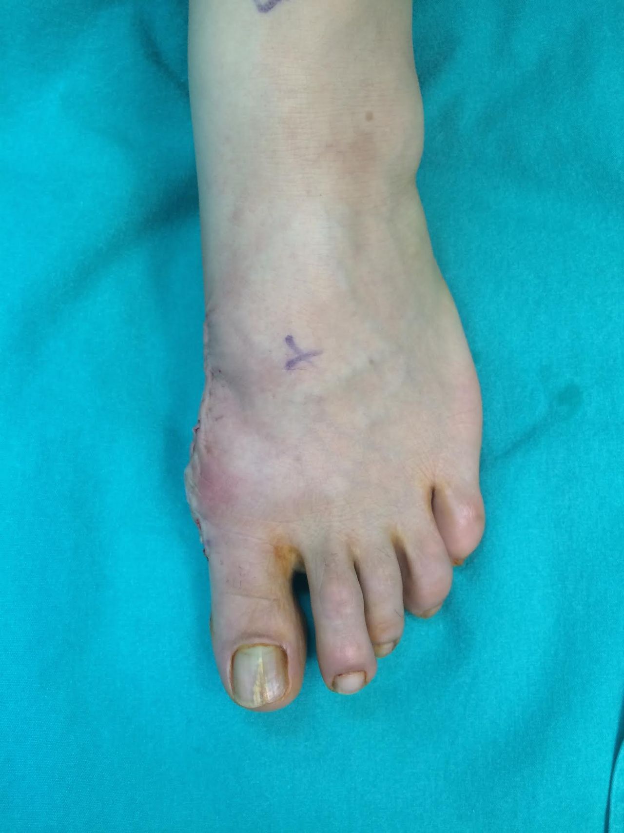 Mehmet Hakan Yılmaz-6