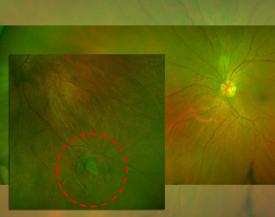 Telmo Xabier Lertxundi Plaza-3