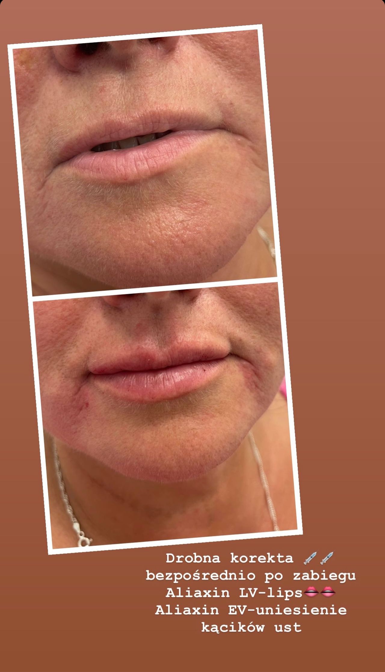 Agnieszka Bacińska-5