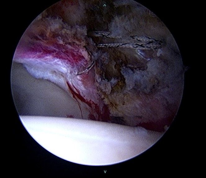 José Valero Lanau-1