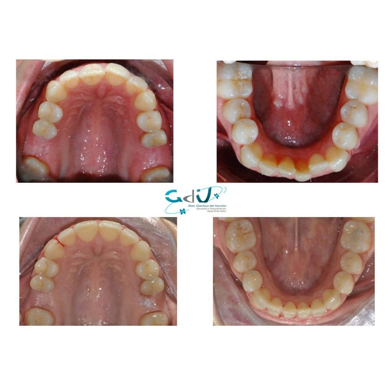 Gianluca Del Vecchio-95