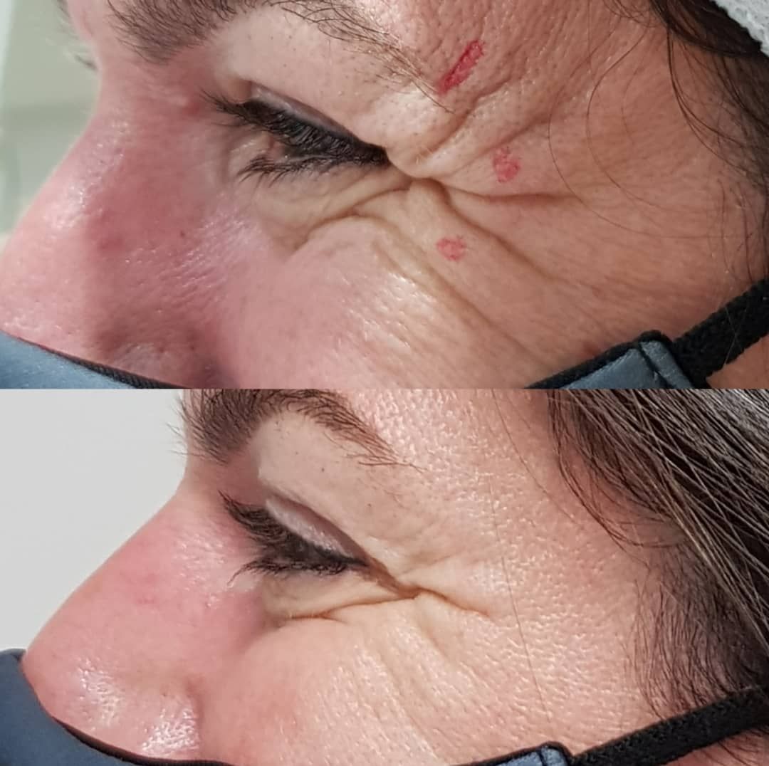 Rosalba Herrero Zerpa-510