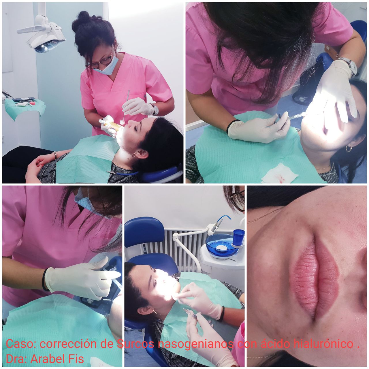 Arabel Fis Rodríguez-18