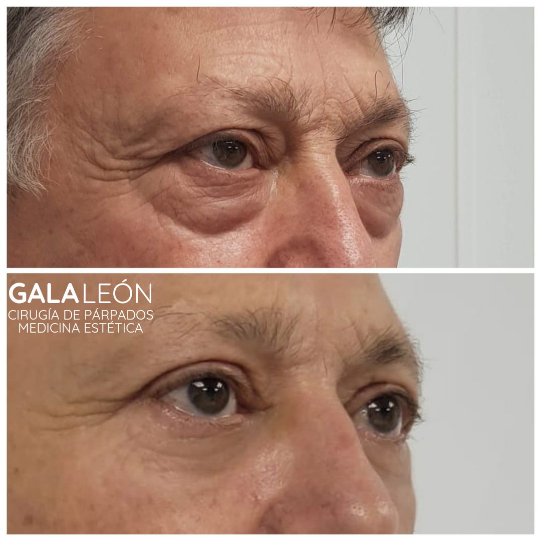 Gala P. Leon Salvatierra-20