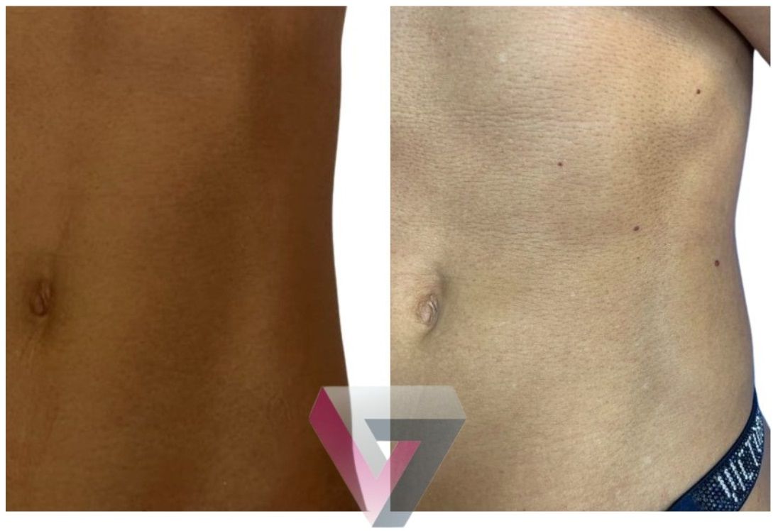 Victoria Trasmonte-74