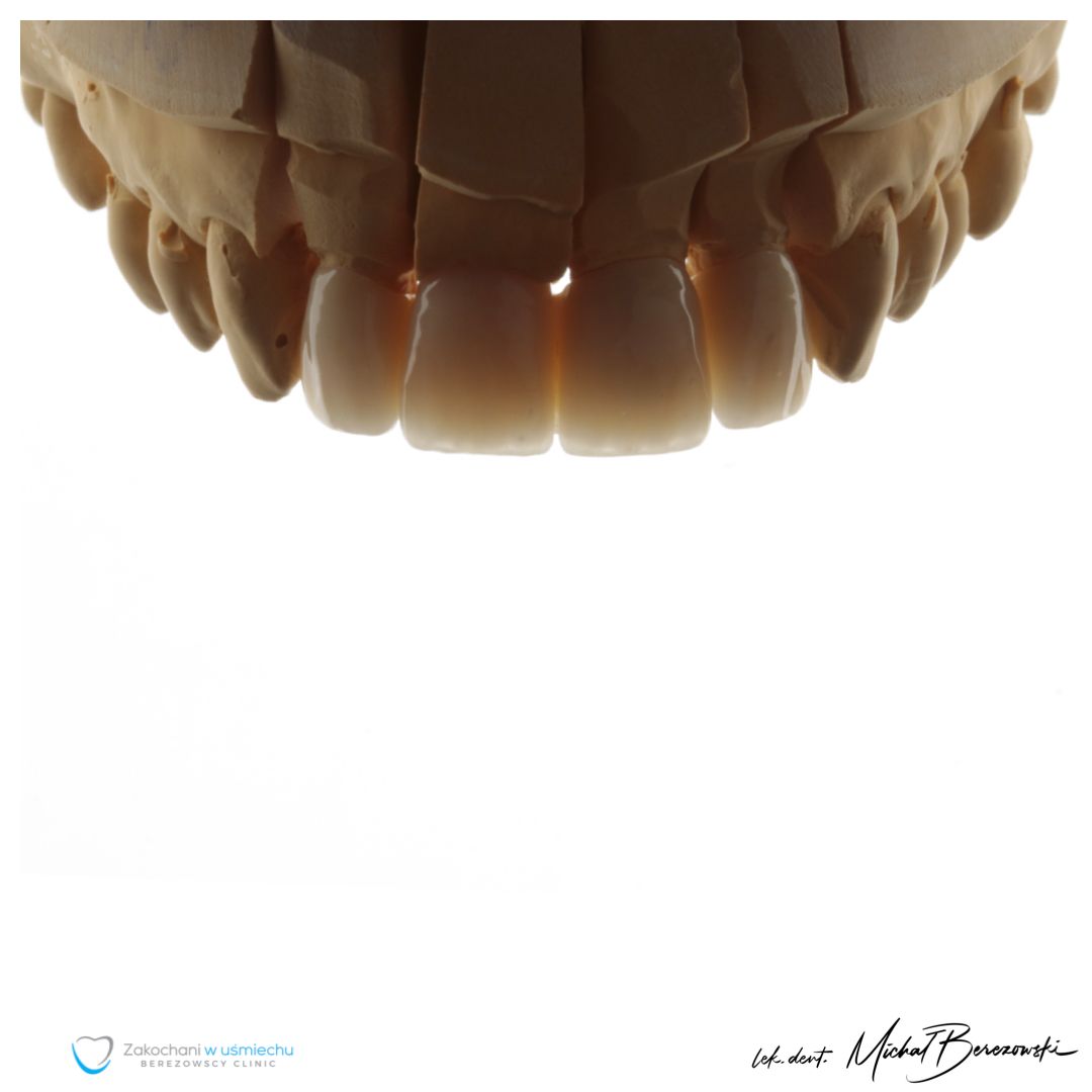 Michał Berezowski-44