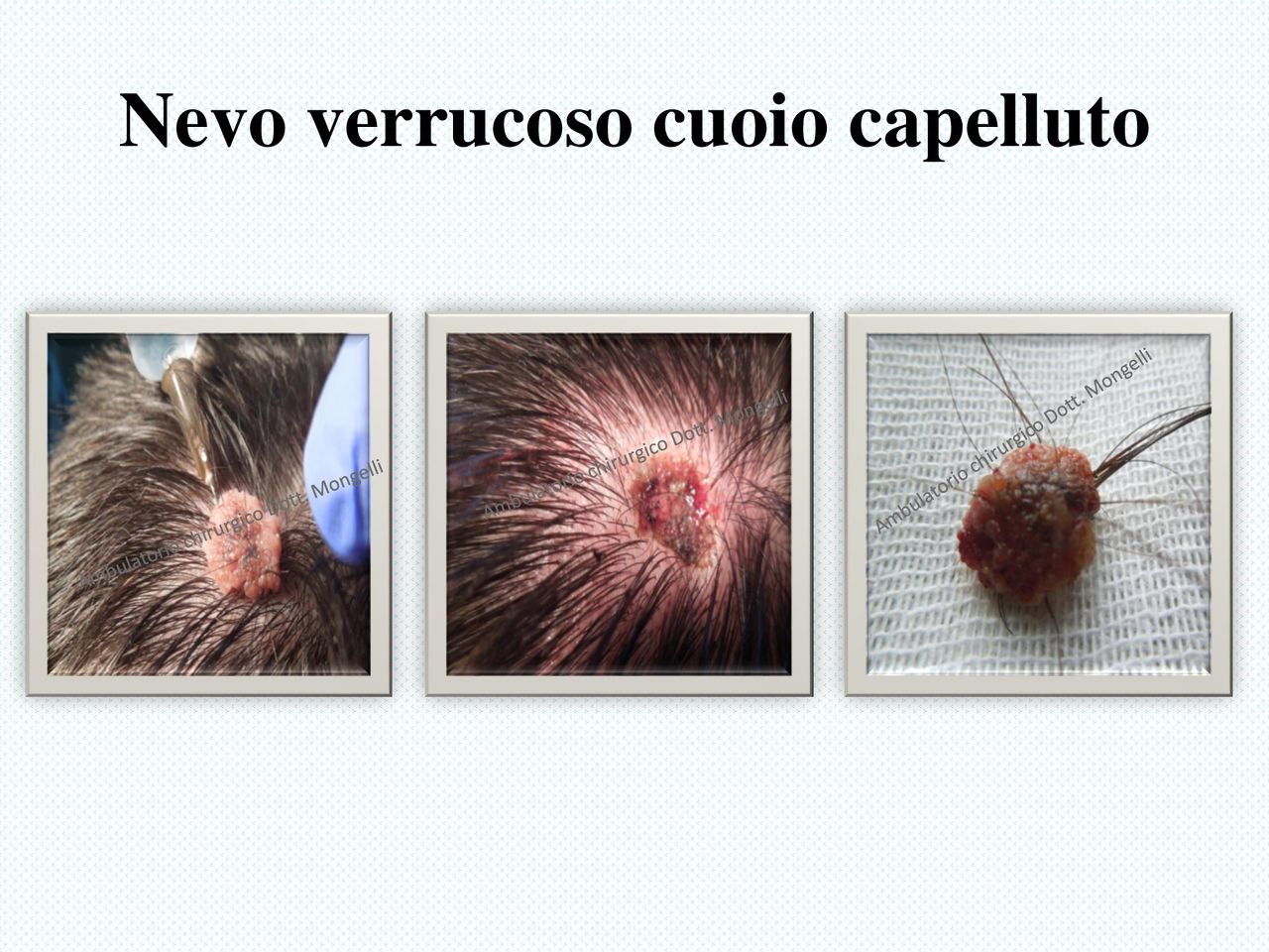 Matteo Antonio Mongelli-13