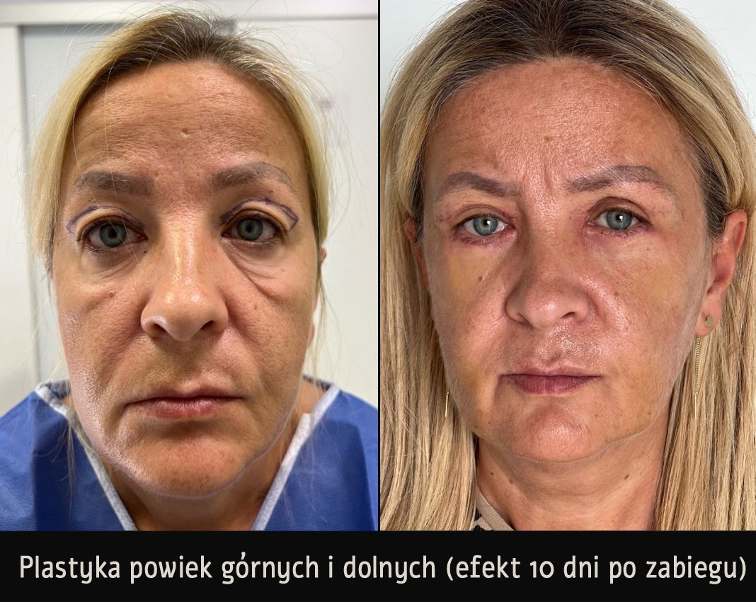 Mariusz Zagajewski-11