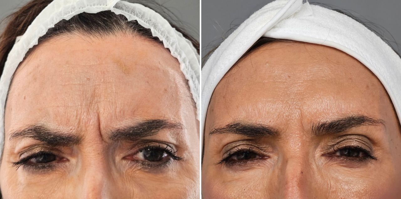 Rosalba Herrero Zerpa-459