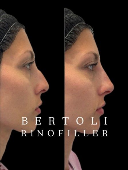 Andrea Bertoli-25