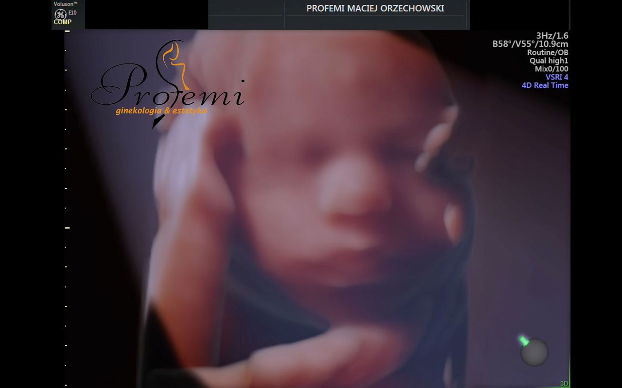 Maciej Orzechowski-20