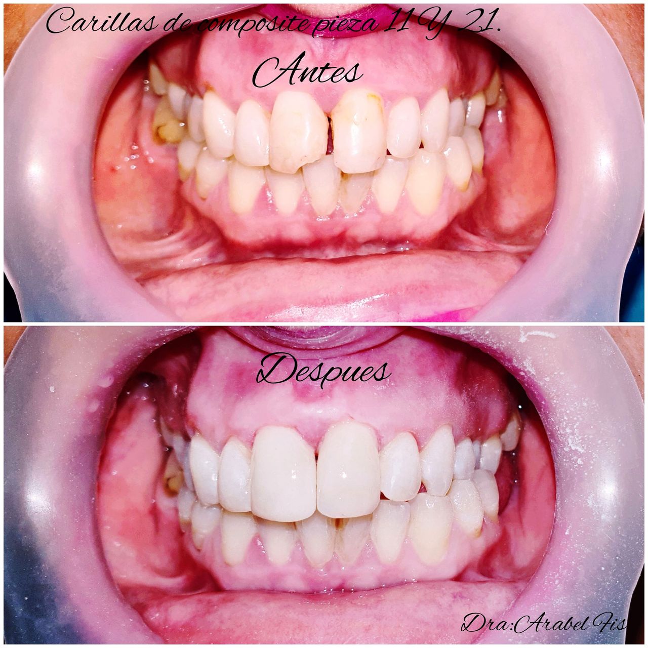 Arabel Fis Rodríguez-13