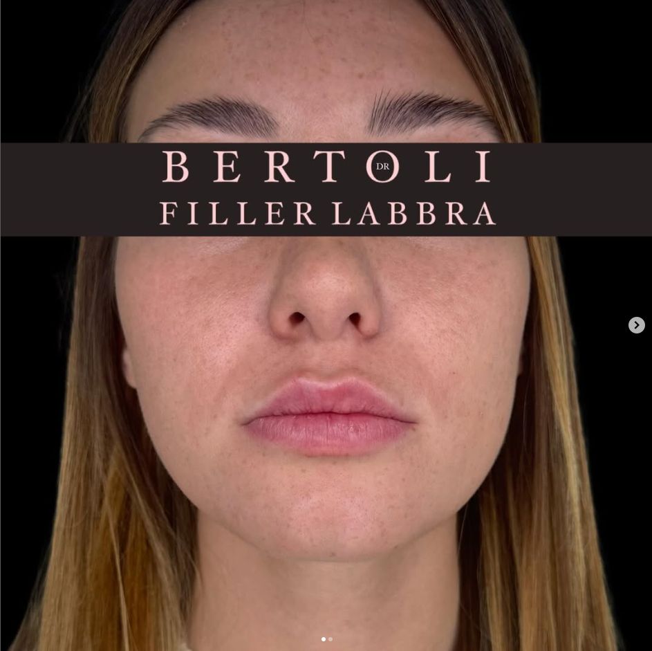 Andrea Bertoli-17