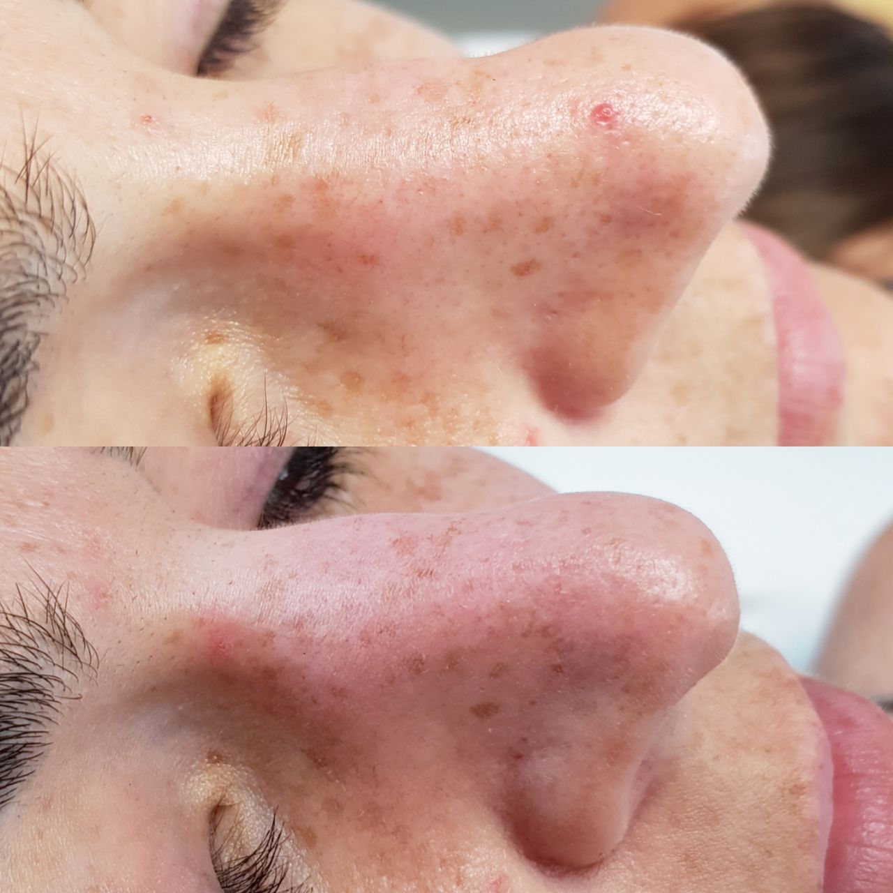 Rosalba Herrero Zerpa-241