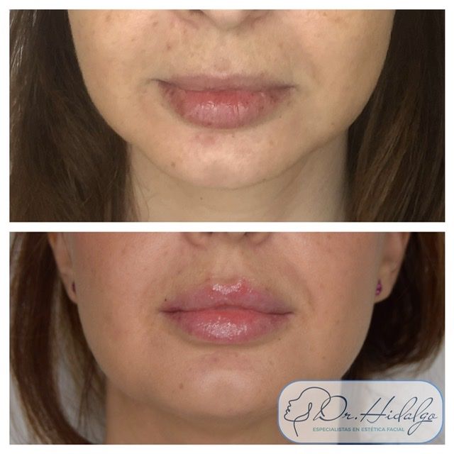 Víctor Hidalgo López-6