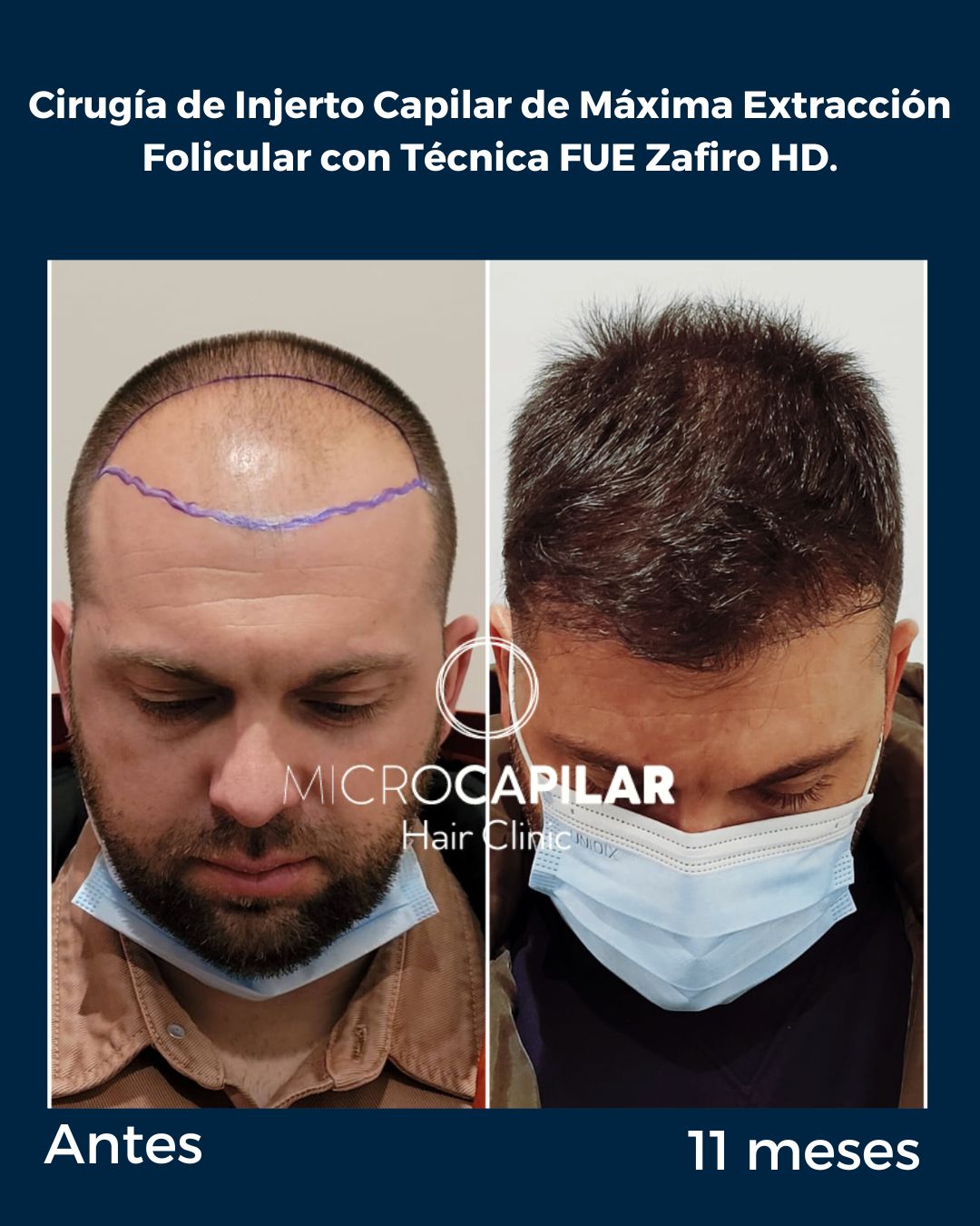 Antonio Fernández Brito-10