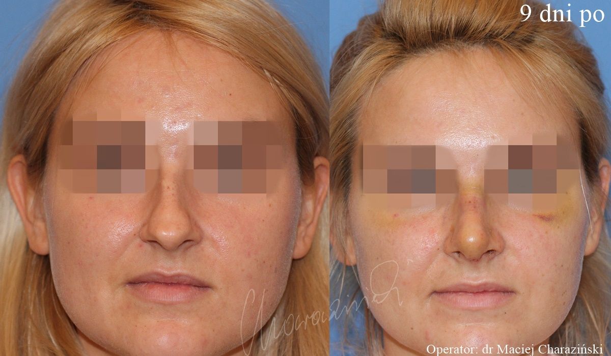 Maciej Charaziński-19