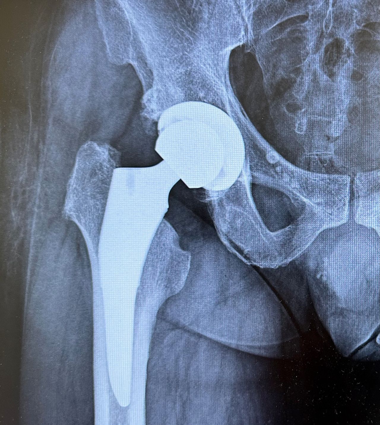 Valerio Cipolloni-16