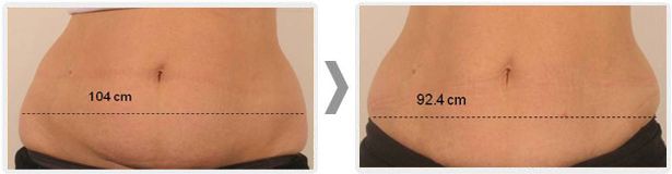 Anita Orzechowska-18