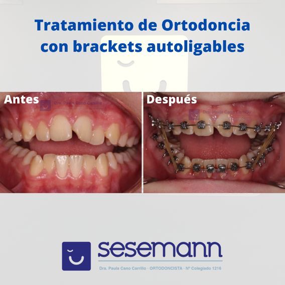 Paula Cano Carrillo-93