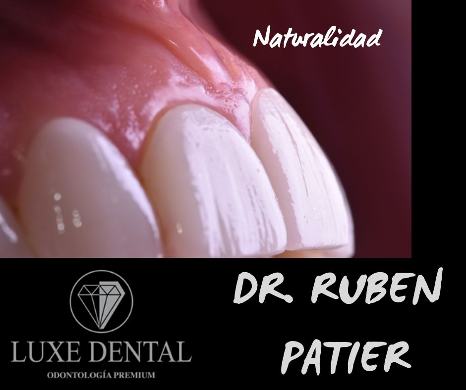 Ruben Patier Martin-27