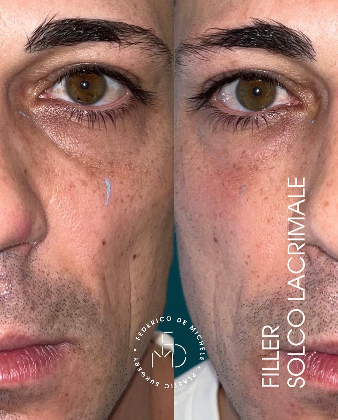 Federico De Michele-9