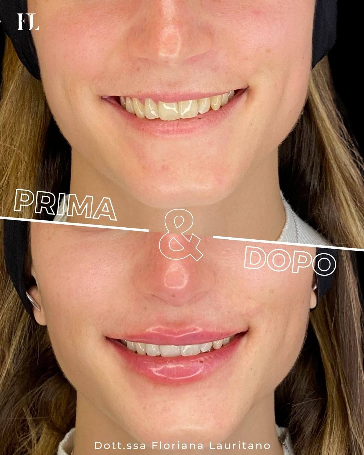 Floriana Lauritano-34