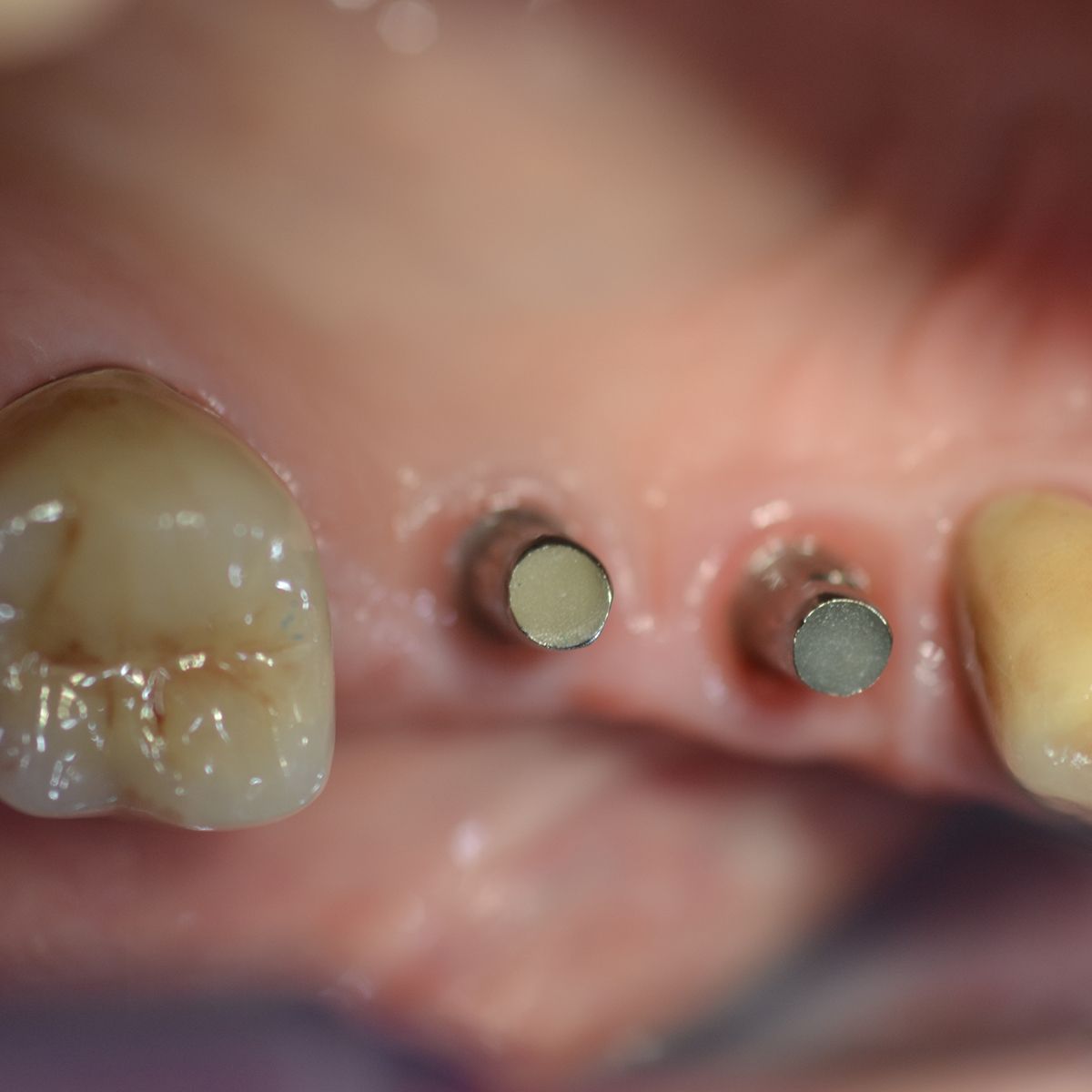 Gianluigi Bittante-68