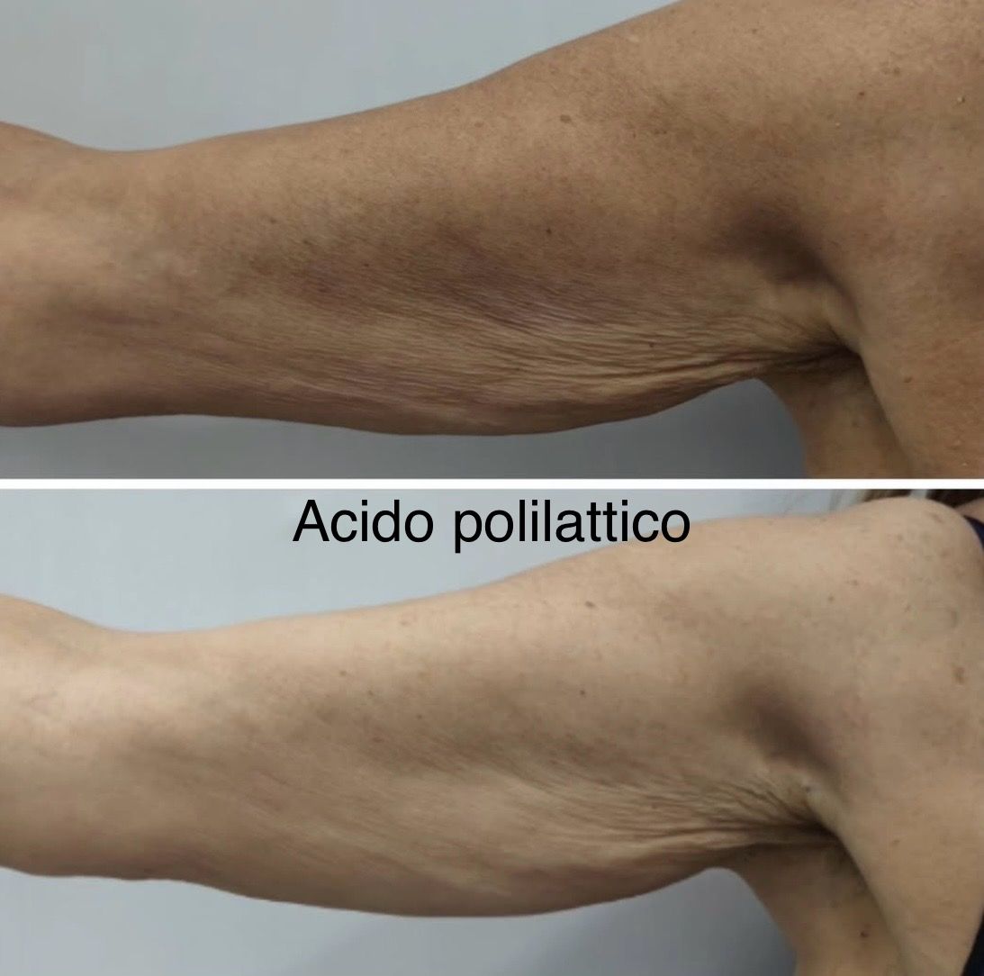 Raffaela Esposito-11