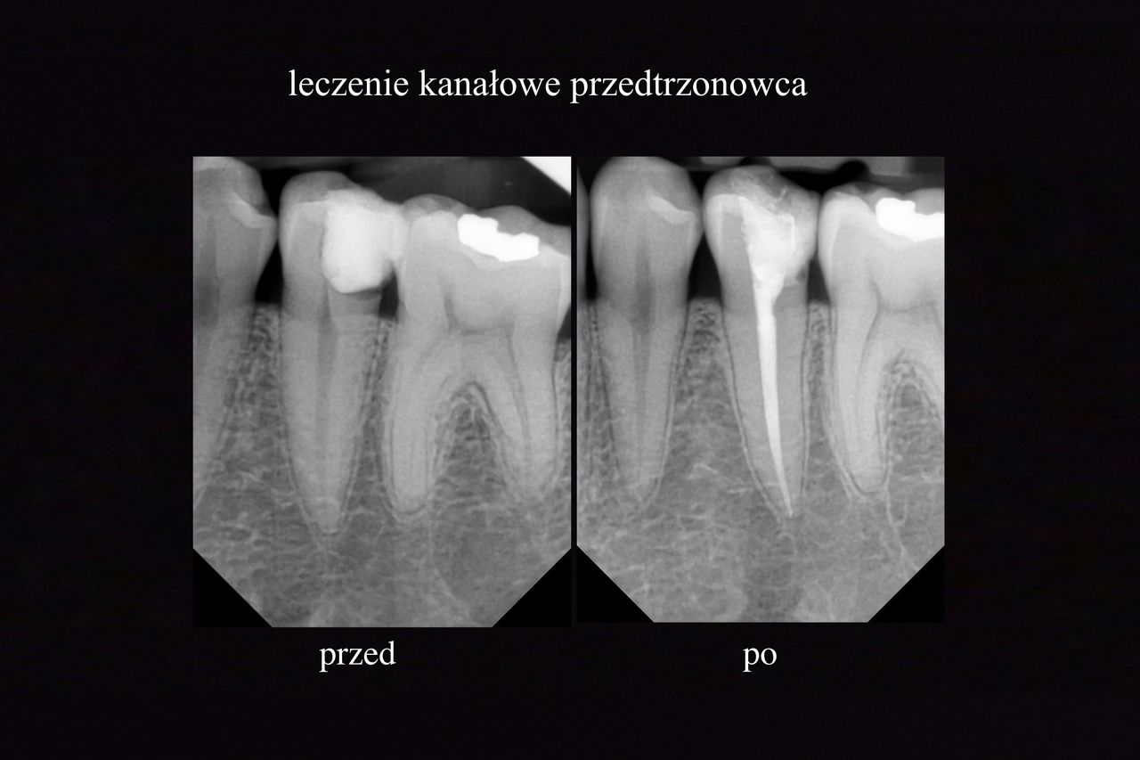 Grzegorz Wójcicki-7