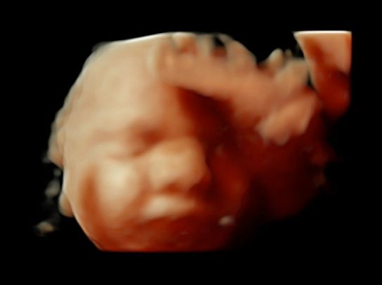 Tommaso Incandela-66