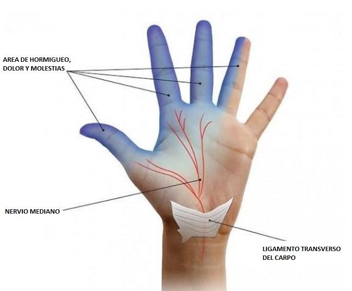 Miguel García Bellón-10
